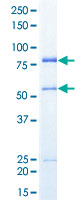 Loading 1 &mu;g protein in SDS-PAGE